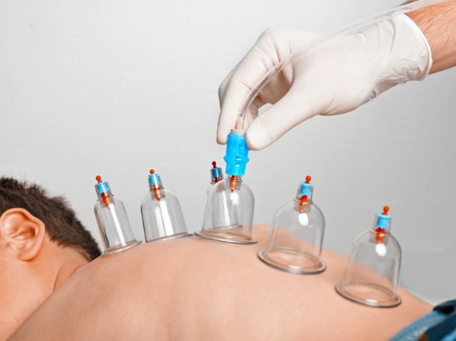 Benefits of Hijama (Cupping Therapy) For The Skin