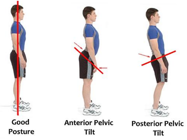 6 Habits That Can Lead to Better Posture