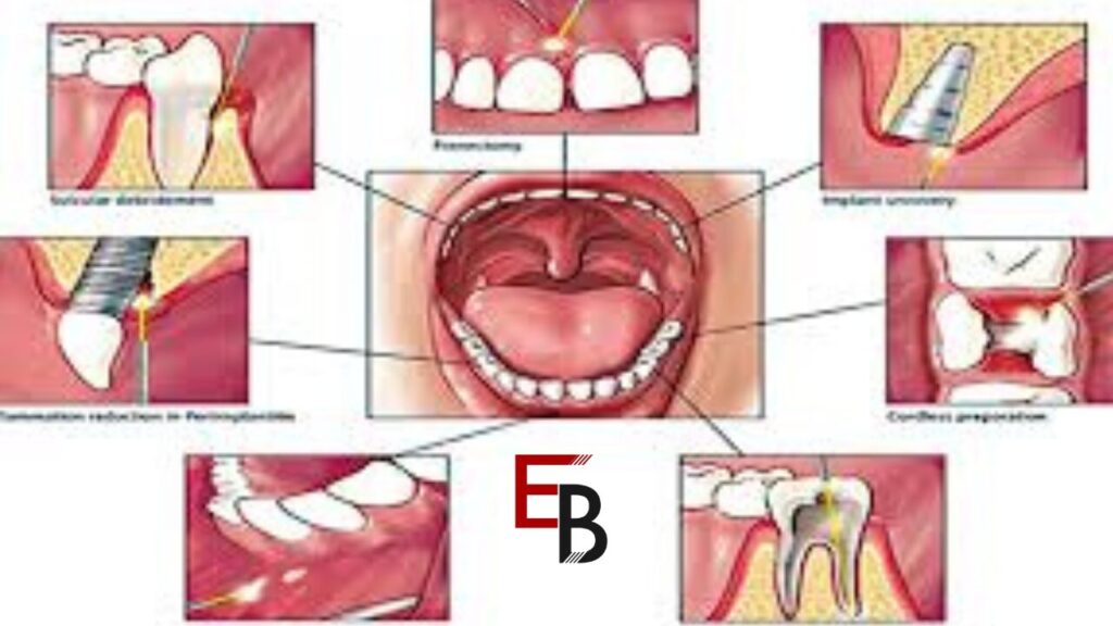 Sectional Matrix Bands