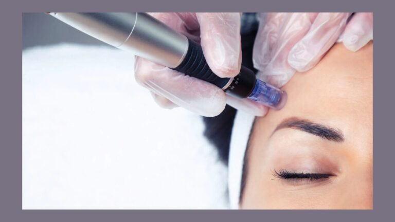 Microneedling
