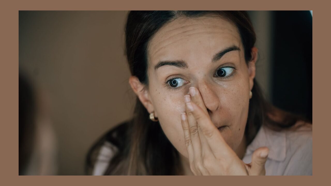 Under-eye bags