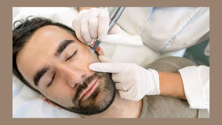 Microneedling