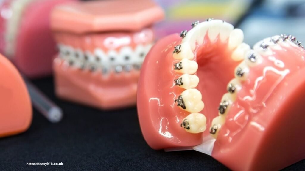 Lingual Braces