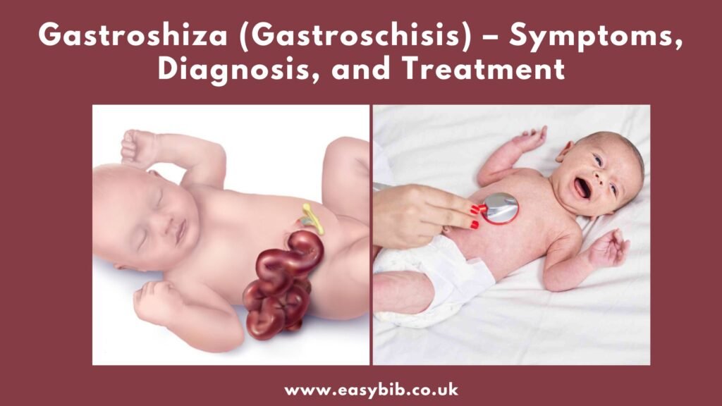 Gastroshiza
